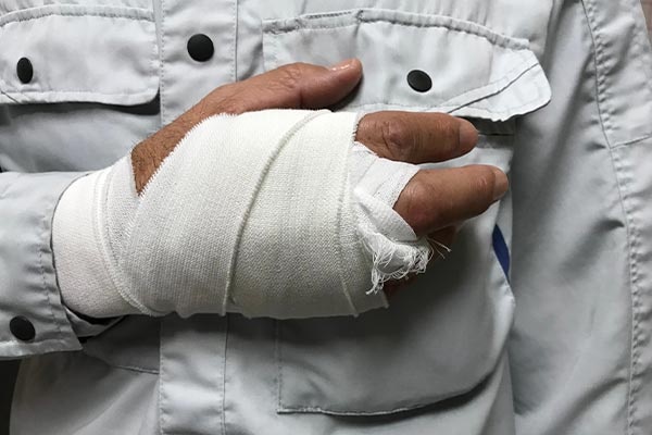 Injured worker with his hand in a cast